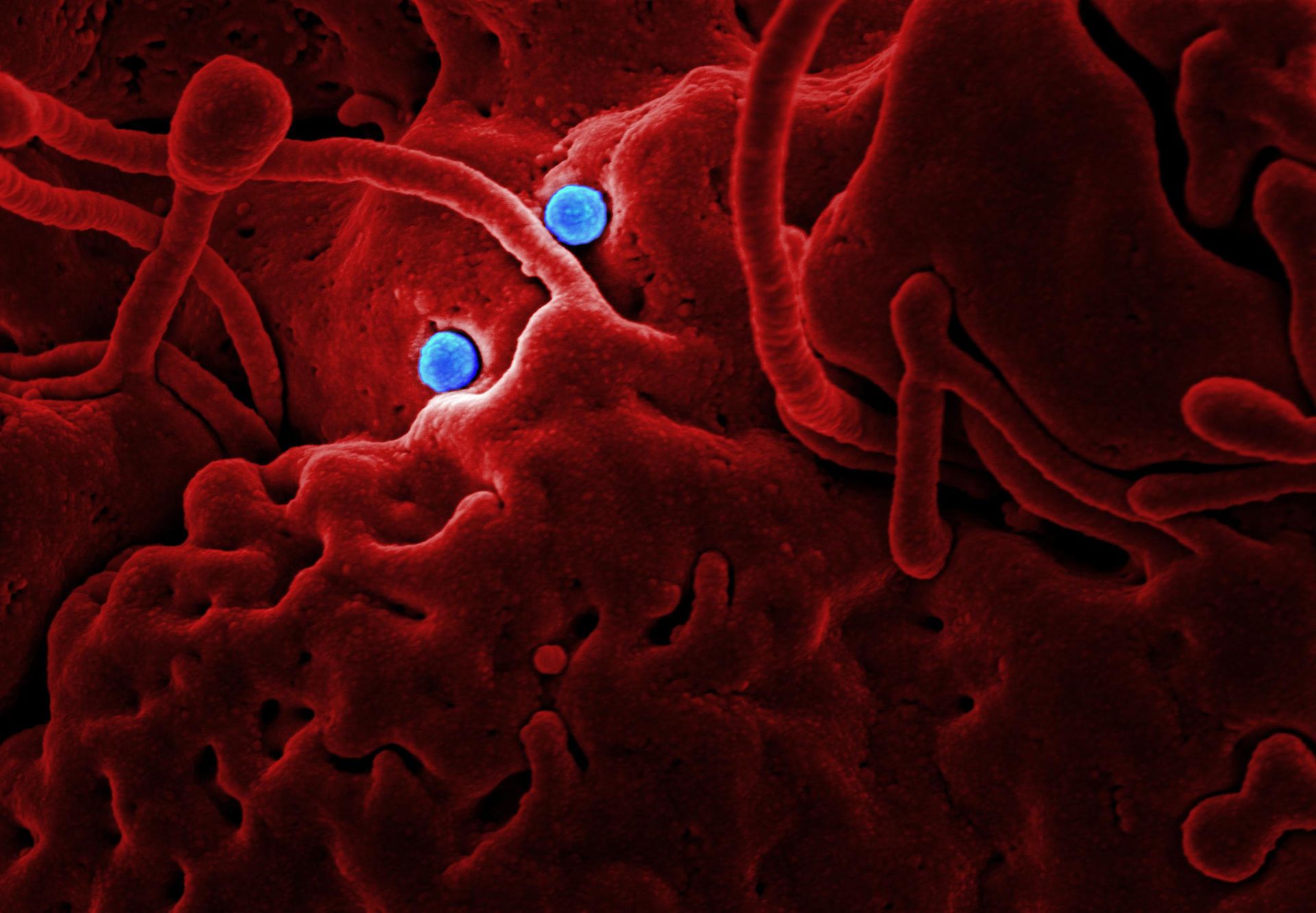 Epidemic: A short story by Aditya Kushwaha